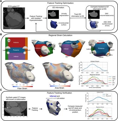 A three-dimensional left atrial motion estimation from retrospective gated computed tomography: application in heart failure patients with atrial fibrillation